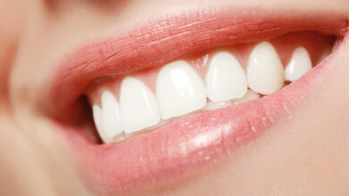 perfect smile