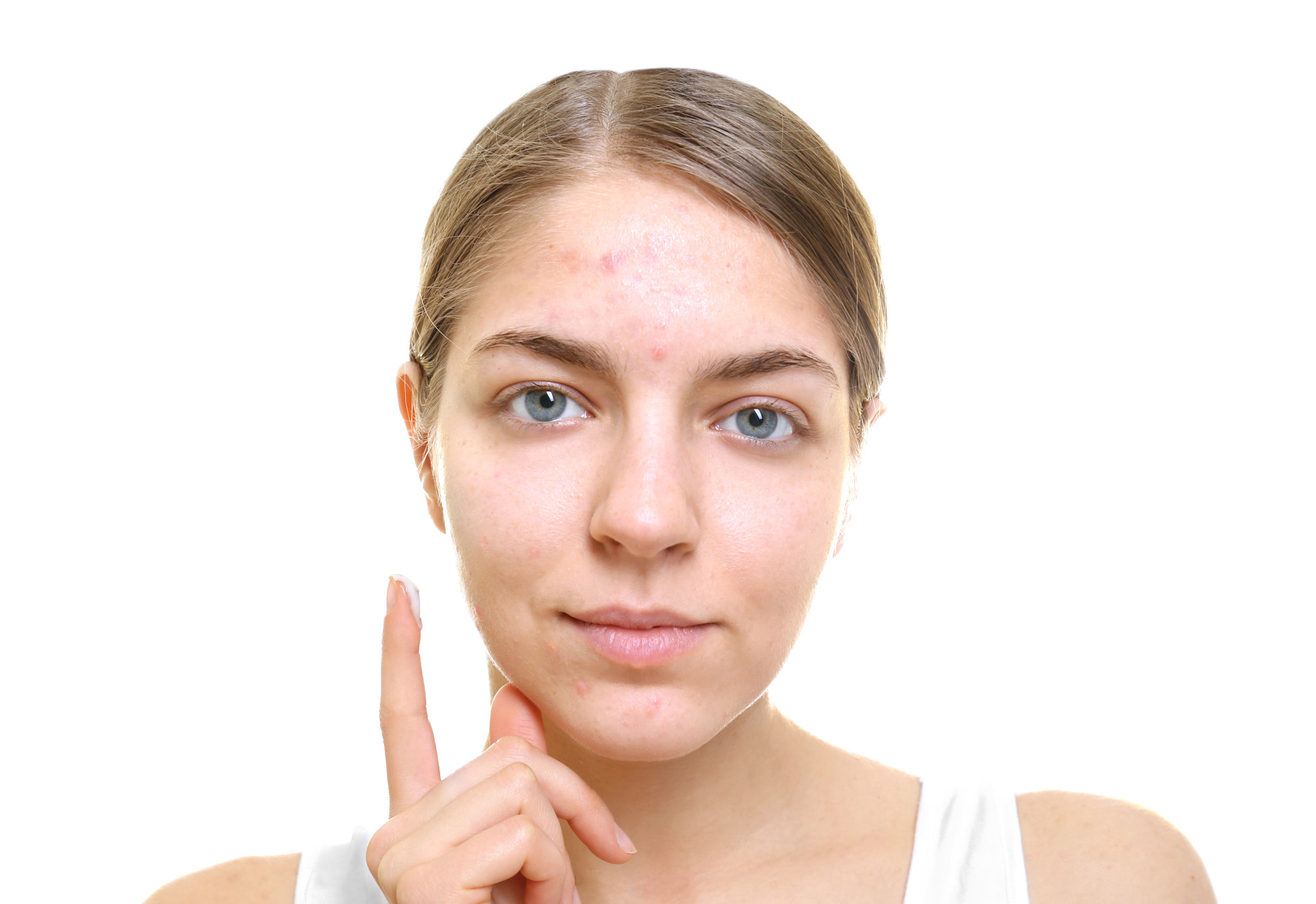 acne removal products