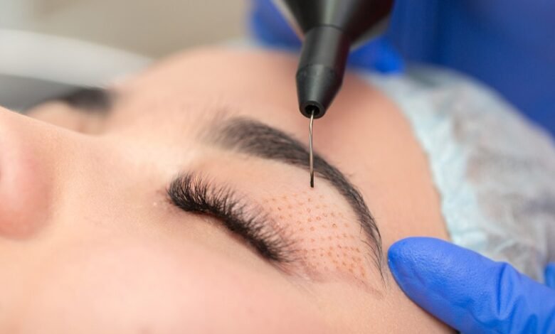 Eyelid Surgery